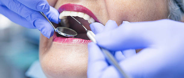 Best Emergency Tooth Extraction in Agua Dulce, CA
